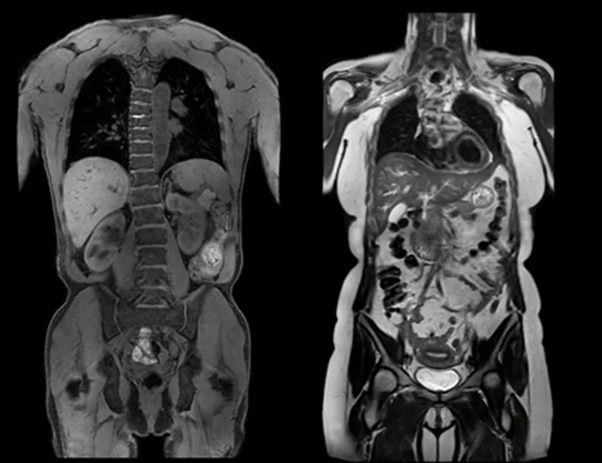 Снимки МРТ грудной, брюшной полости, органов малого таза 