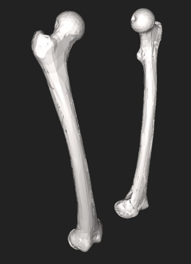 Бедренная кость