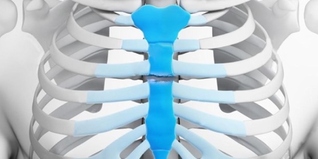 Макетное изображение перелома тела грудины (закрашена синим цветом)