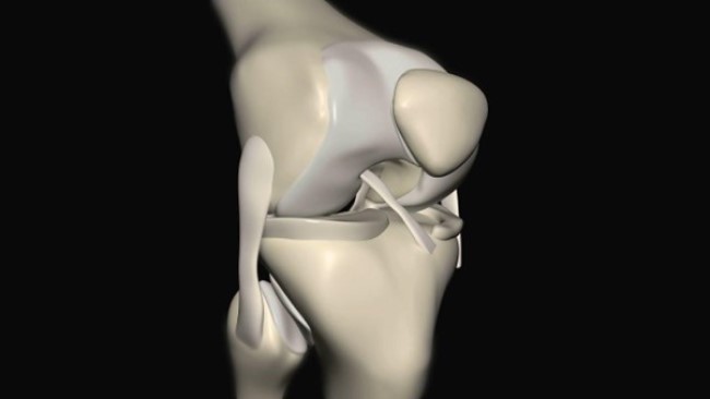 Коленный сустав состоит из дистального эпифиза бедренной кости, проксимального отдела большеберцовой кости и надколенника