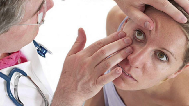 Ухудшение зрения, выпадение полей, мелькание мушек, головная боль, обильные выделения - симптомы, подразумевающее обращение за помощью к специалисту