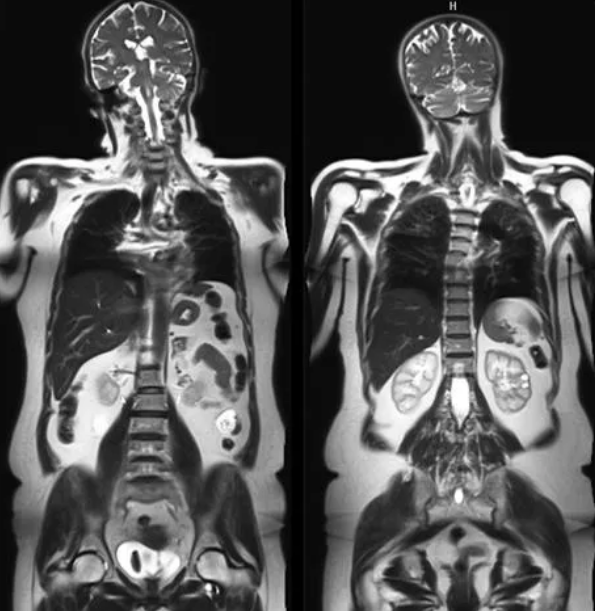 С помощью магнитно-резонансной томографии можно увидеть мягкие и плотные структуры организма без выполнения разрезов на теле