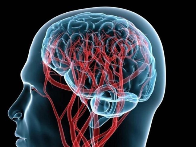 Схематическое изображение сосудистой сети головного мозга